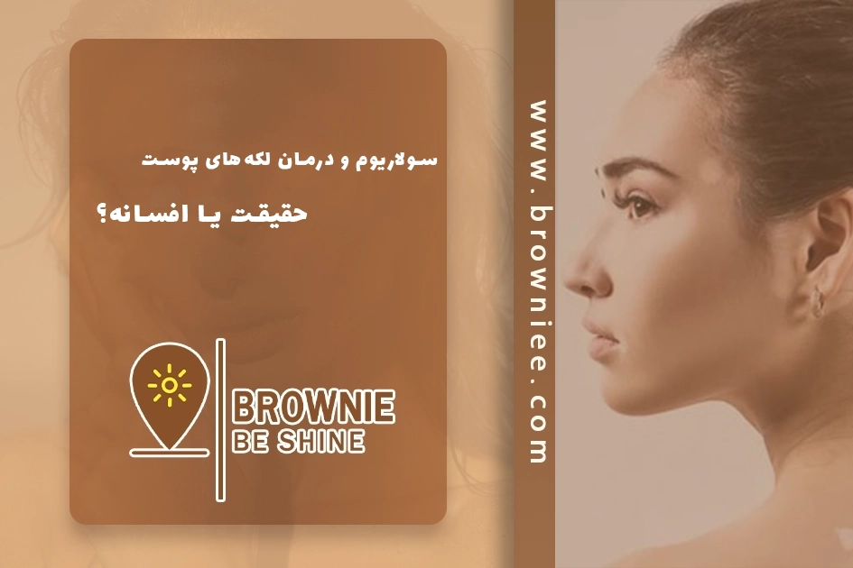 سولاریوم و درمان لکه‌های پوست: حقیقت یا افسانه؟