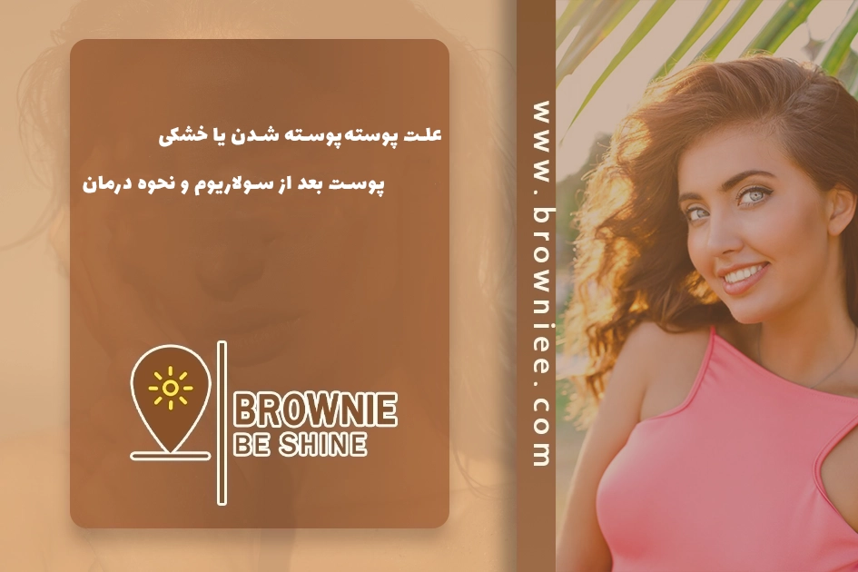 علت پوسته‌پوسته شدن یا خشکی پوست بعد از سولاریوم و نحوه درمان